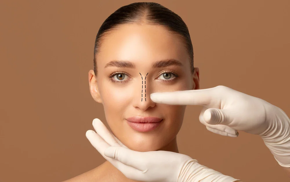 Rhinoplasty (Nose Surgery)