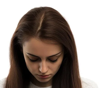 Female Hair Transplant after result