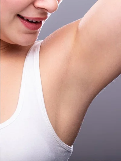 Laser Hair Removal For Women after result