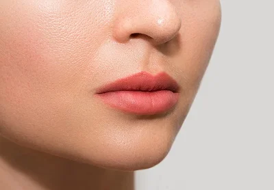 Lip Lift after result