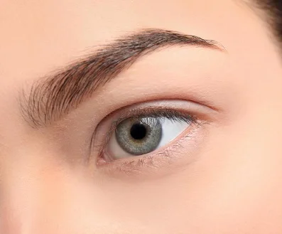 Eyebrow Transplant before result