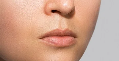 Lip Lift before result