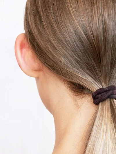 Otoplasty & Earlobe Repair before result