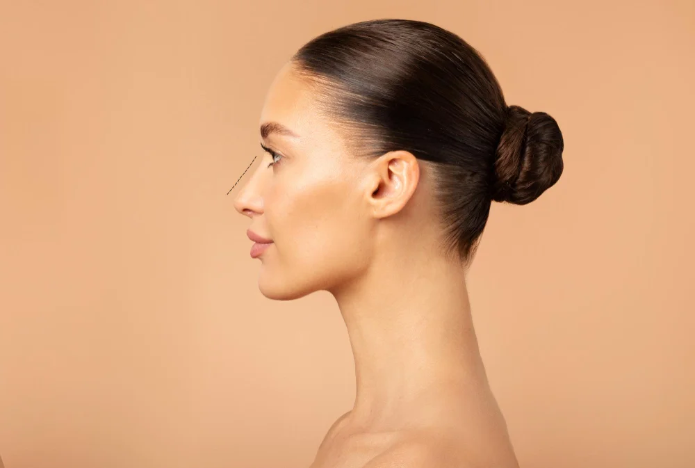 Rhinoplasty Feature Image